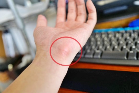 生産性up パソコン作業の手首の痛みを回避 おすすめマウスレスト