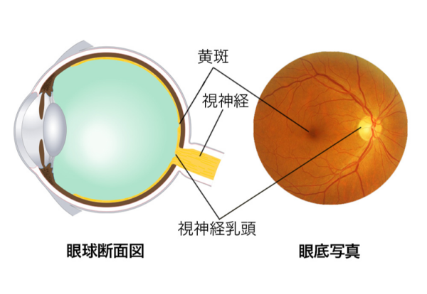 眼球断面図と眼底写真で黄斑の位置